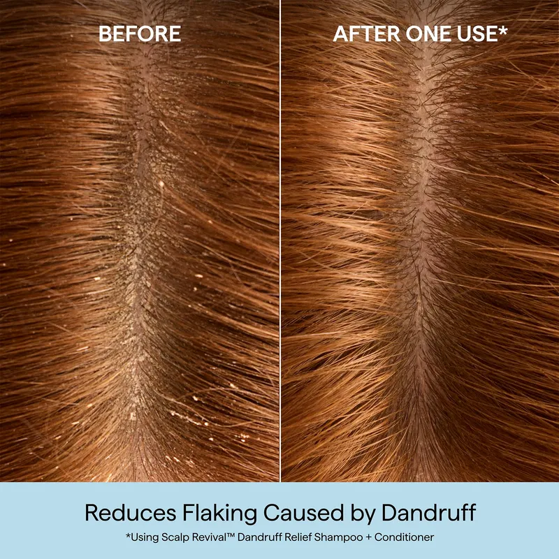 Bild 2 för Briogeo Scalp Revival™ Dandruff Relief Shampoo 248 ml