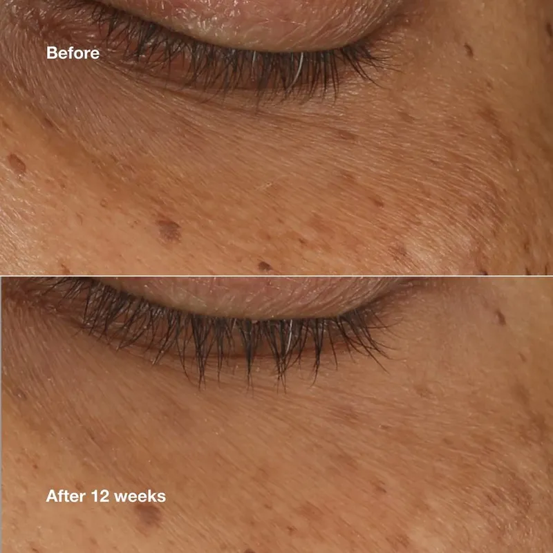 Bild 2 för Clinique All About Eyes Brightening Serum Concentrate 10 ml