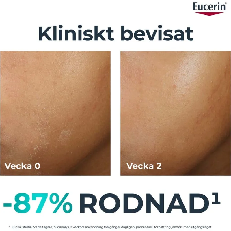 Bild 2 för Eucerin DermoPure Hydra Repair 40 ml