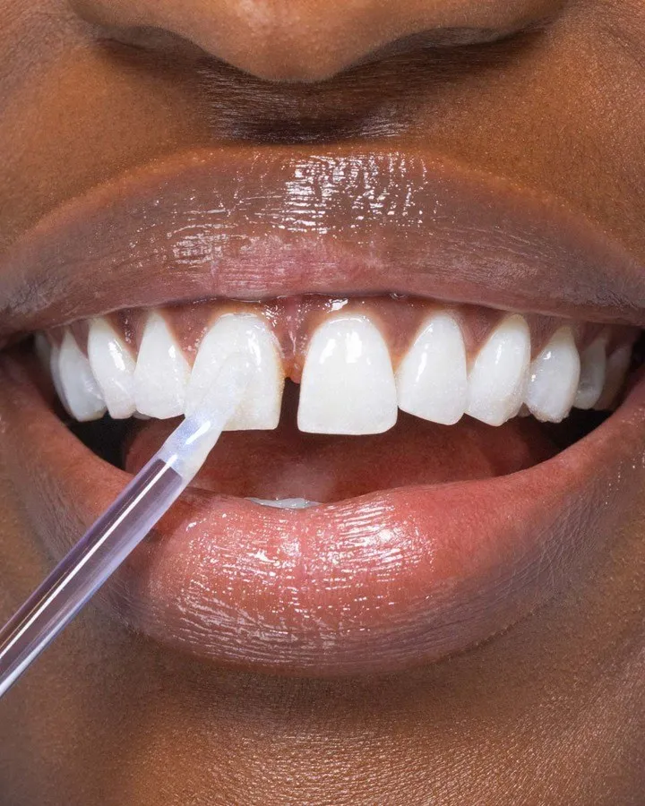 Bild 5 för Hismile Glostik Tooth Gloss 4 ml
