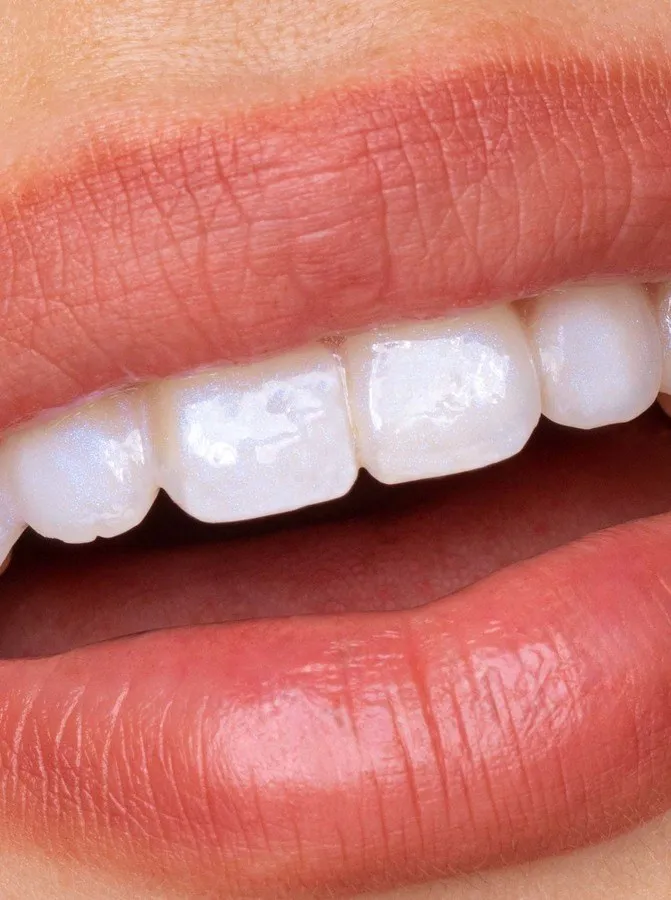 Bild 7 för Hismile Glostik Tooth Gloss 4 ml