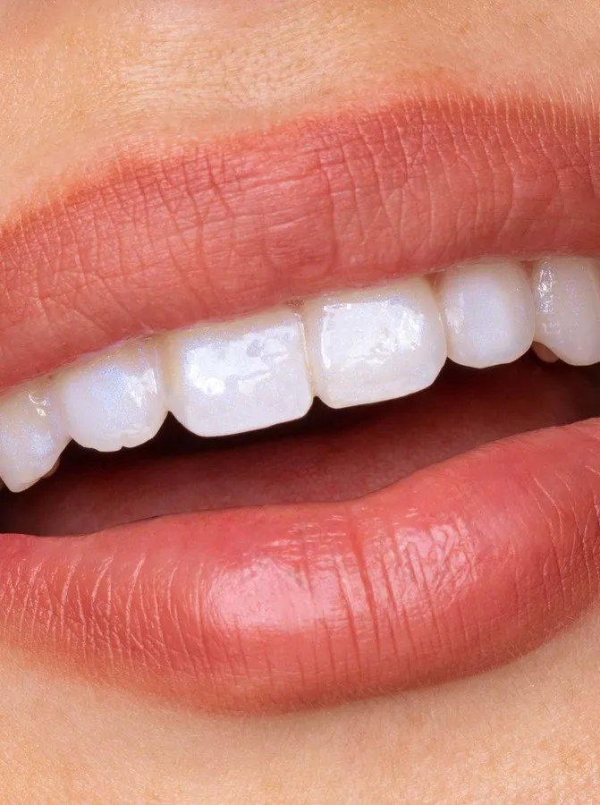 Bild 8 för Hismile Glostik Tooth Gloss 4 ml
