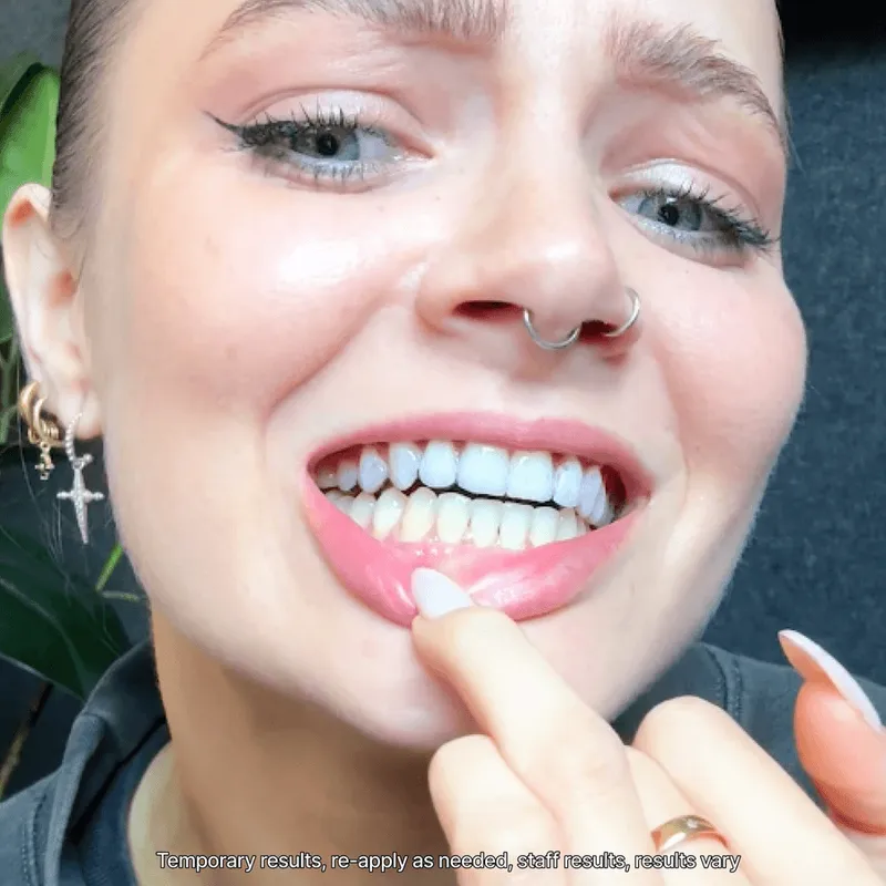 Bild 4 för Hismile V34 Teeth Whitening Strips