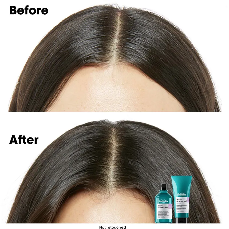 Bild 2 för L'Oréal Professionnel Scalp Advanced Serie Expert Professional Shampoo