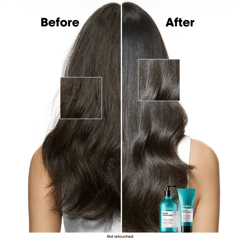 Bild 3 för L'Oréal Professionnel Scalp Advanced Serie Expert Professional Shampoo