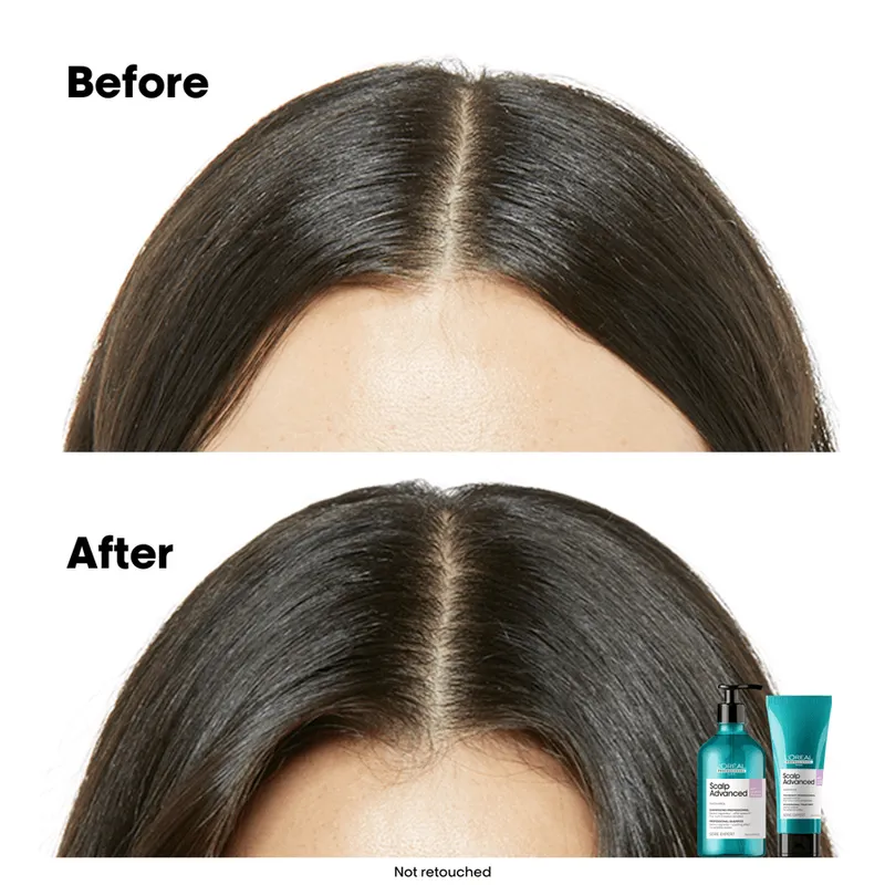 Bild 5 för L'Oréal Professionnel Scalp Advanced Serie Expert Professional Shampoo