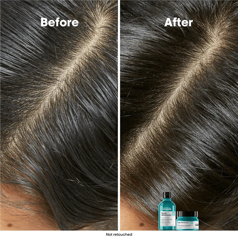 Bild 5 för L'Oréal Professionnel Scalp Advanced Serie Expert Professional Shampoo