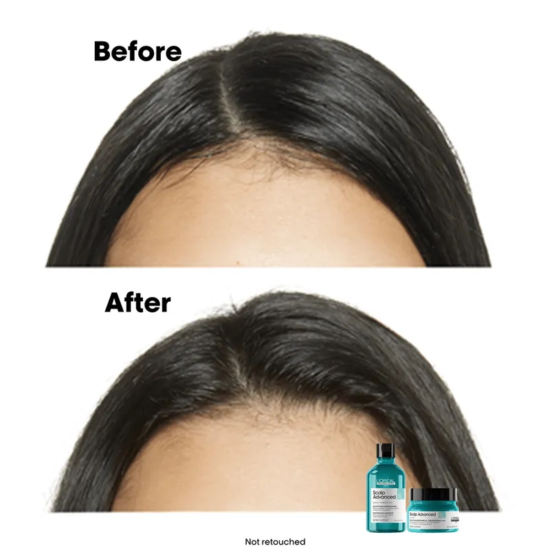 Bild 6 för L'Oréal Professionnel Scalp Advanced Serie Expert Professional Shampoo