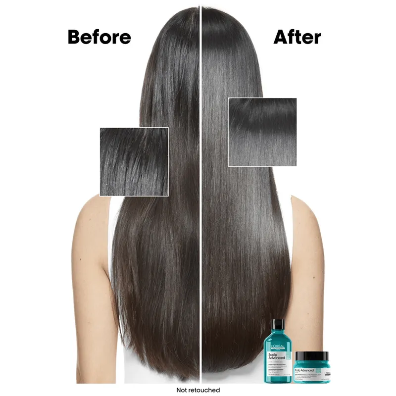 Bild 7 för L'Oréal Professionnel Scalp Advanced Serie Expert Professional Shampoo