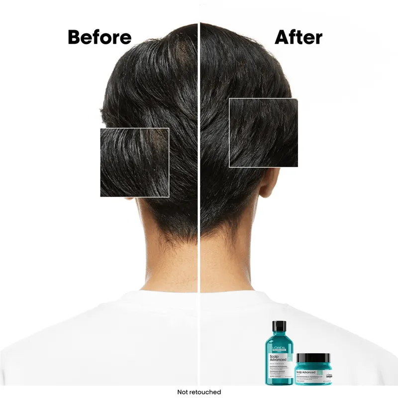 Bild 8 för L'Oréal Professionnel Scalp Advanced Serie Expert Professional Shampoo