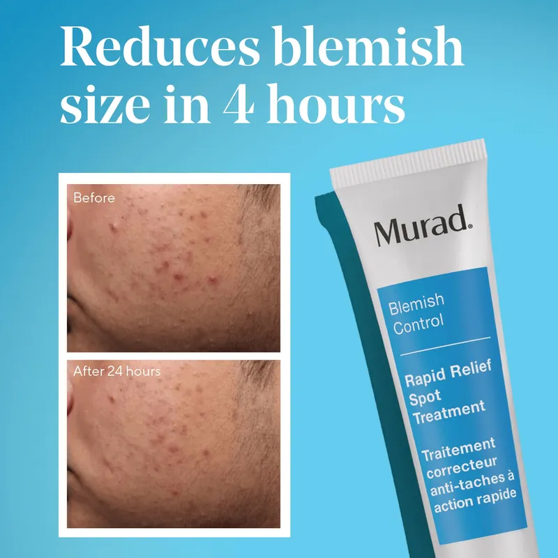 Bild 2 för Murad Blemish Control Rapid Relief Spot Treatment  15 ml