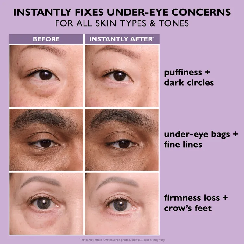 Bild 10 för Peter Thomas Roth Instant FIRMx® Eye Temporary Eye Tightener Easy-Wear 20 ml + Brush