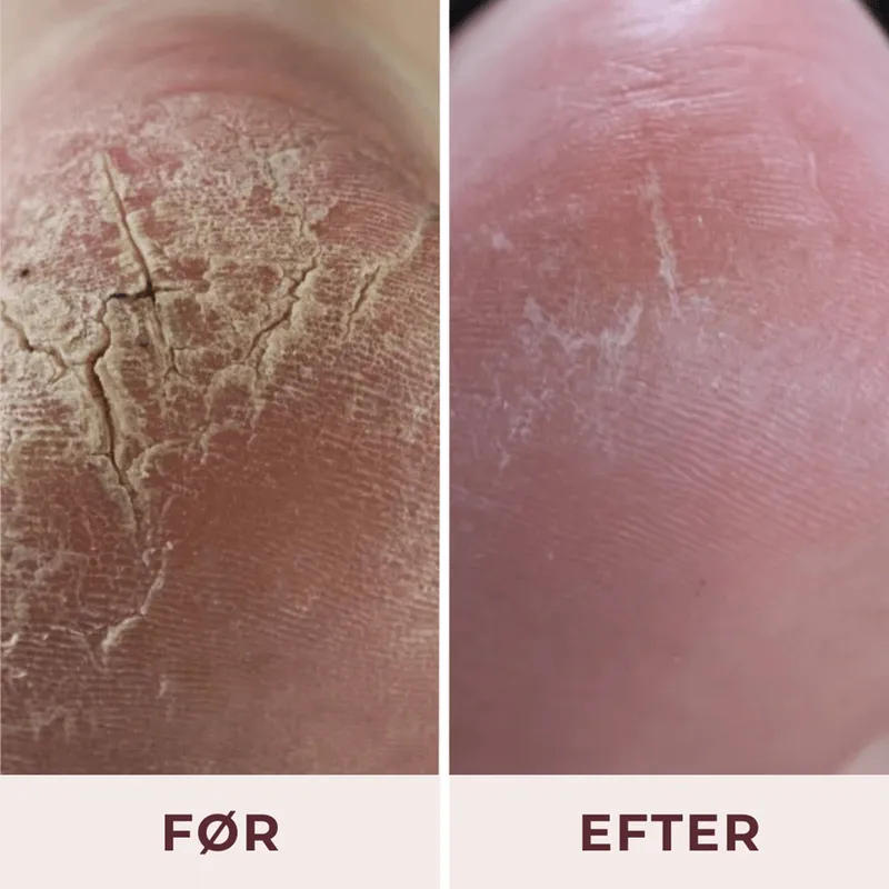 Bild 4 för Pudderdåserne All-in-One Foot lotion 100 ml